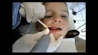 QuickSleeper - Dental Hi Tec