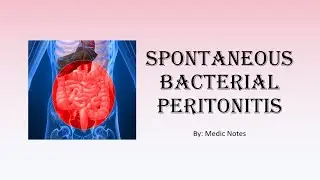 Spontaneous bacterial peritonitis - common organisms, clinical features, investigation, treatment