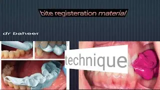 bite registeration material (clincal tips)fixed prothodontics