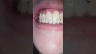 Your new House | Uvula | Vore | Male Vore