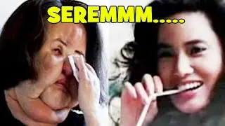 Operasi Plastik Tiap Minggu, Wajah Model Korea Ini Jadi Bengkak dan Mengerikan