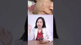 Cùng phân tích Routine với BS Hằng nha! #bacsidalieu #skinstudio #bacsihang #skincare