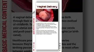 Vaginal Delivery 