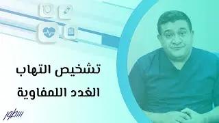 تشخيص التهاب الغدد اللمفاوية