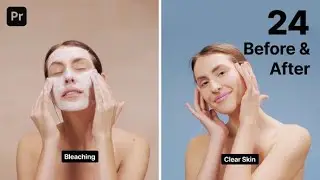 Premiere Pro Template: Before and After