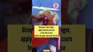 How to treat Baby Watery Eyes| Nasolacrimal duct obstruction