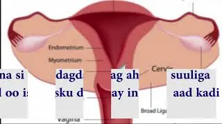 ka hortagida uurka dumarka qalan ama nuujinaya