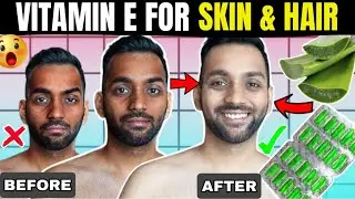 12 Useful Beauty Hacks You Must Try 😍 Remove Dark Spots, Pigmentation, Tan, Blackheads, DIY Facial😀