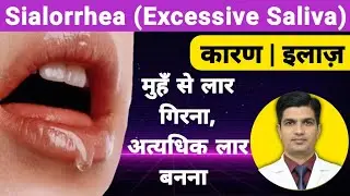 Excessive saliva :- Causes & Treatment  | Sialorrhea