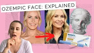Is OZEMPIC Ageing Your Face? | What is OZEMPIC FACE? Dr Sarah Explains.