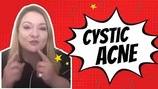 What is cystic acne, blind pimples and how to best manage a skin with acne