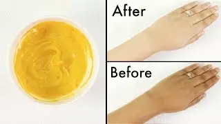 How To Remove Tan From Face,Neck,Hands,Knees Overnight| Simple home remedie