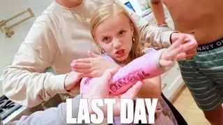 LAST DAY IN A CAST FOR TWO BROKEN ARM BONES