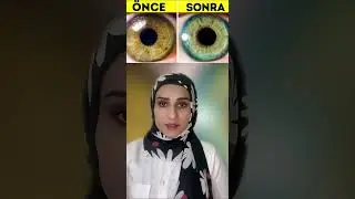 The real eye color of brown-eyed people 