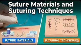 Suture Materials and Suturing Techniques