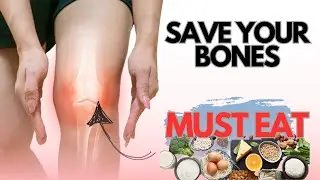 Supercharge Your Bones and Teeth with These Essential Nutrients!