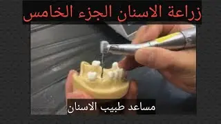 #زراعة_الأسنان الجزء الخامس #dental_assistant #سلسله_مساعد_طبيب_الاسنان