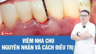 Bệnh viêm nha chu là gì? nguyên nhân và cách điều trị