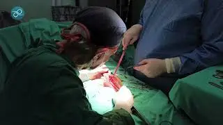 Penil Protez (Mutluluk Çubuğu) Ameliyatı Nasıl Yapılır? Prof. Dr. Yavuz Önol