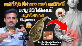 How To Remove Gallbladder Stone without Operation || Dr. Ravikanth Kongara || SumanTV Deepti