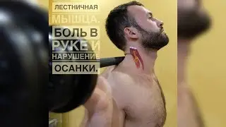 Синдром 