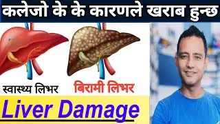 हाम्रो लिभर के कारणले खराब हुन्छ? cause of liver problems in Nepali! #liver