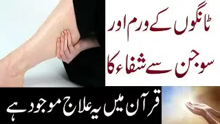 Tango Ke Warm Ka Ilaj | Tango Ki Sujan Ka Ilaj In Urdu | Naqsh For Legs Pain
