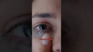 Yks'ye Aylar Kala Her Şeyi Değiştiren Bu Öğrenciyi Tanıyor Musun?