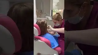 Установка аппарата для исправления прикуса 