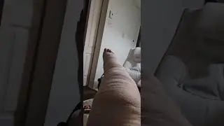 long leg cast