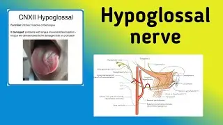 Hypoglossal Nerve || Cranial Nerve 12 Pathway, Nerve Lesion