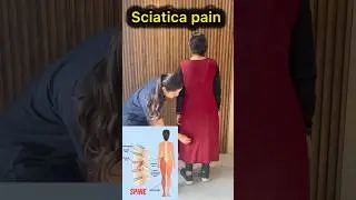 Sciatica pain exercises 