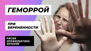 ГЕМОРРОЙ ПРИ БЕРЕМЕННОСТИ: РИСКИ, ПРОФИЛАКТИКА, ЛЕЧЕНИЕ / DOCTOR UKOLOV