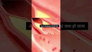 3 Reasons for Heart Attack | जानें heart Attack क्यों आता है | Animation | Explained | Circulation