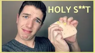 GROSS Pimple Popping Toy Reaction!!