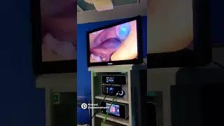 ot  #youtubeshorts #dr #shortvideo