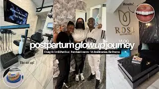 Glow Up Journey: Fixing My Teeth Pt.2 | Porcelain Veneers + My Real Reaction, The Process & More!