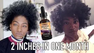 I. done. saved. my. DAMAGED. 4C. hair. | StarPuppy vs Hair Growth + SBR LIQUID BIOTIN GIVEAWAY