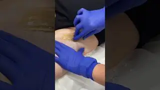 Полное видео с процессом есть на моем канале #депиляция #шугаринг #шугарингобучение