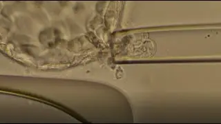 Flicking – Human Blastocyst Biopsy Without Laser Assistance (RGI).
