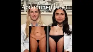 How to make your tummy look its best! with Sam & Meg