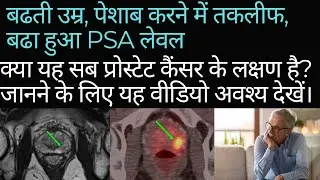 प्रोस्टेट कैंसर #prostatecancerinhindi #prostatecancerkyahotahai #petct #mri