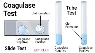 COAGULASE TEST PRACTICAL & THEORY VIDEO 💥🦠|| Coagulase Test for Staphylococcus aureus @MLTclass 🩸