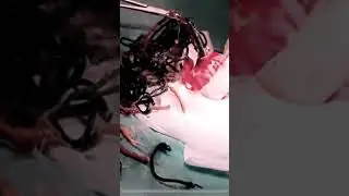 That’s why don’t let your pet chew objects || Foreign body ingestion