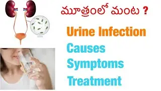 మూత్రంలో మంట?/urine infection, causes/symptoms/treatment/precautions/more in diabetes patients.