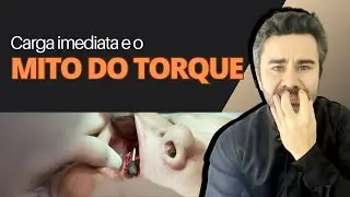 O Mito do Torque nos Implantes para Carga Imediata
