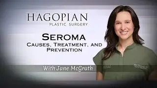 Understanding Seroma After Surgery Causes, Treatment, and Prevention