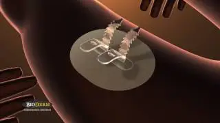 CathGrip Application Demo