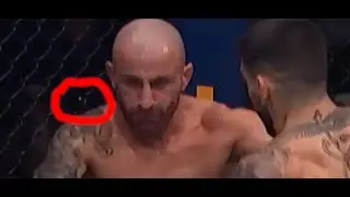 Alexander Volkanovski's tooth flying