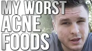 The Two Worst Acne Foods & the Best Food for Acne